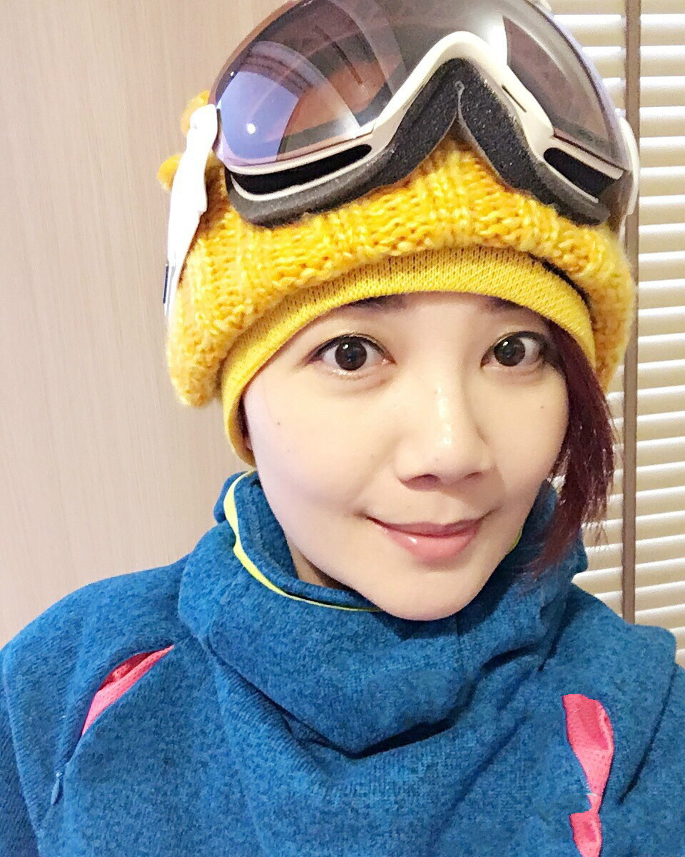 女人脸上八字纹面相图解,脸上有三个八字纹的面相