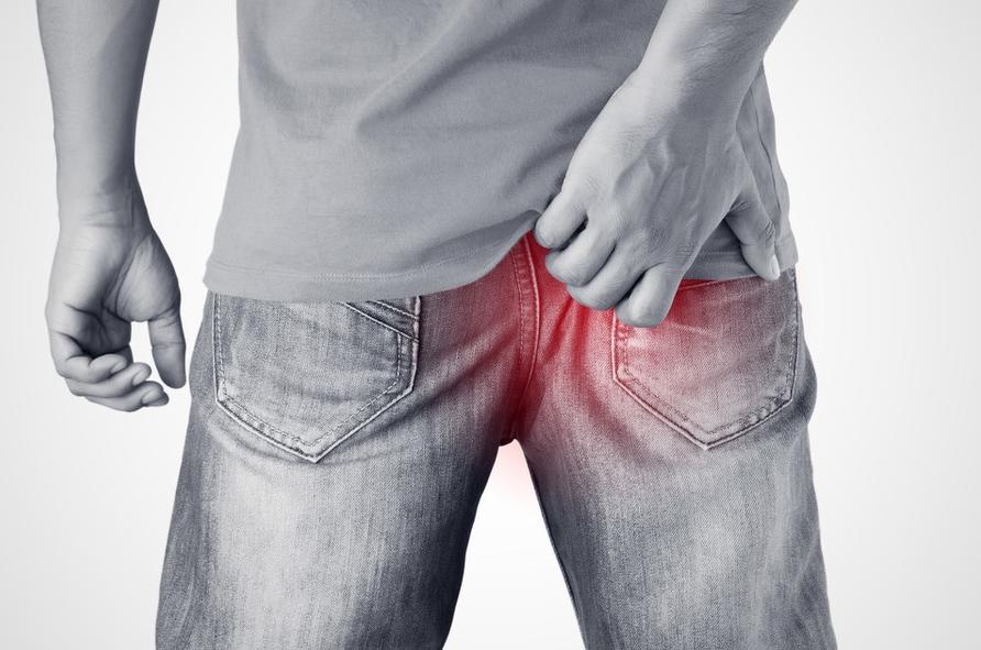 痔疮肛门周围都肿是什么痔疮,肛门肿胀有痔疮疼痛