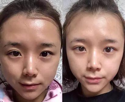 火山泥真是宝,油皮女孩的毛孔疏通剂,让贵妇霜3秒吃透锁水8倍