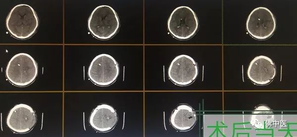 警惕熬夜,注意别仗着年轻就透支自己的身体