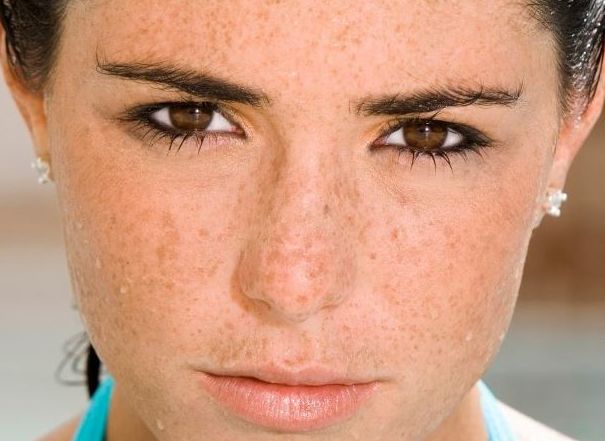 祛斑除皱美白肌肤,面部祛斑美白淡斑小妙招