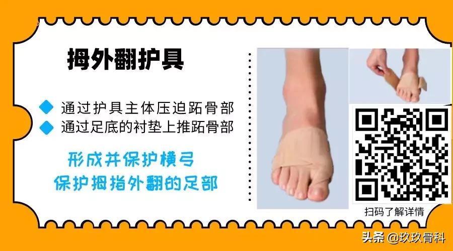拇外翻大脚骨矫正工具正确用法,拇外翻和大脚骨有什么区别