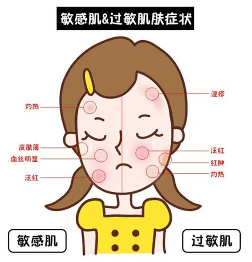 医学美容产品一览表,医学美容激光科