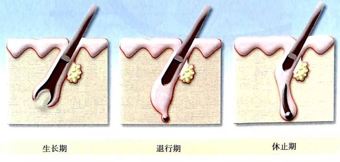 张柏芝早期发际线形状,张柏芝完美发际线
