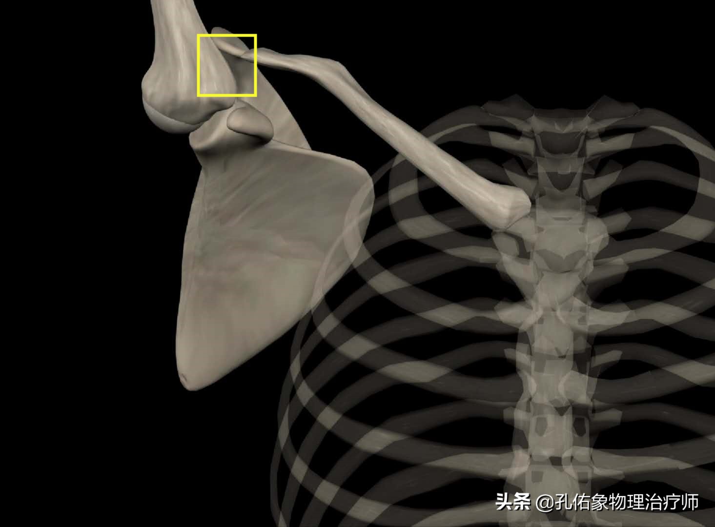 肩膀中风疼痛快速缓解方法,中风后左肩膀痛怎么办