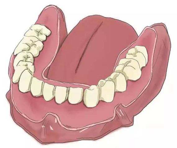 都说种植牙贵难道保护牙齿很难吗,谈谈种植牙对牙床的损害