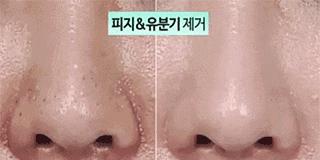 喷雾式的去黑头的东西,去黑头收缩毛孔吸黑头神器测评