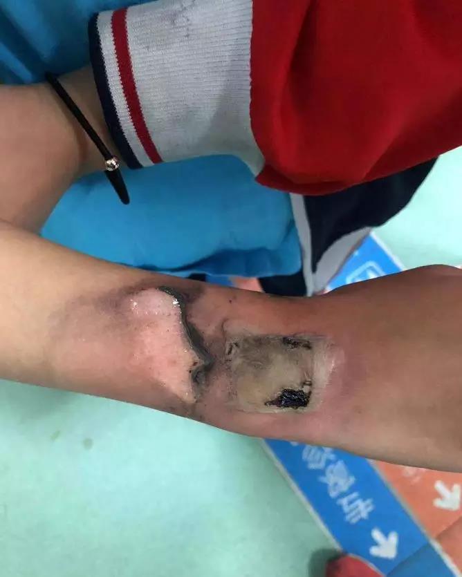 紧急提醒孩子天天用的东西,紧急提醒孩子带什么东西