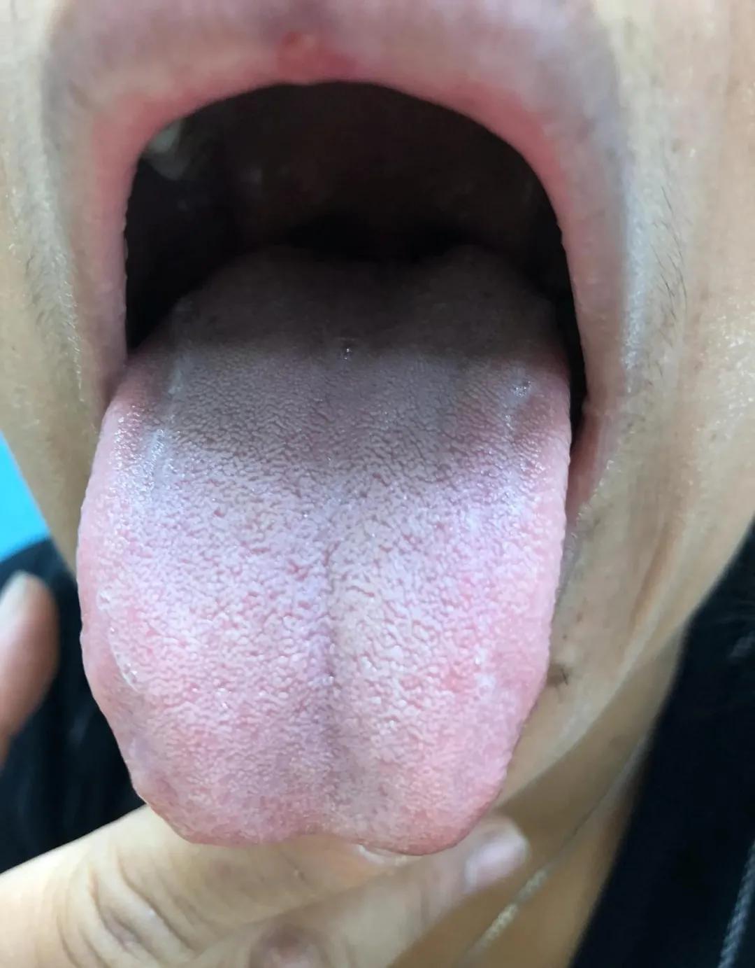 体质寒凉的人怎么调理,体质又寒又热怎么调理