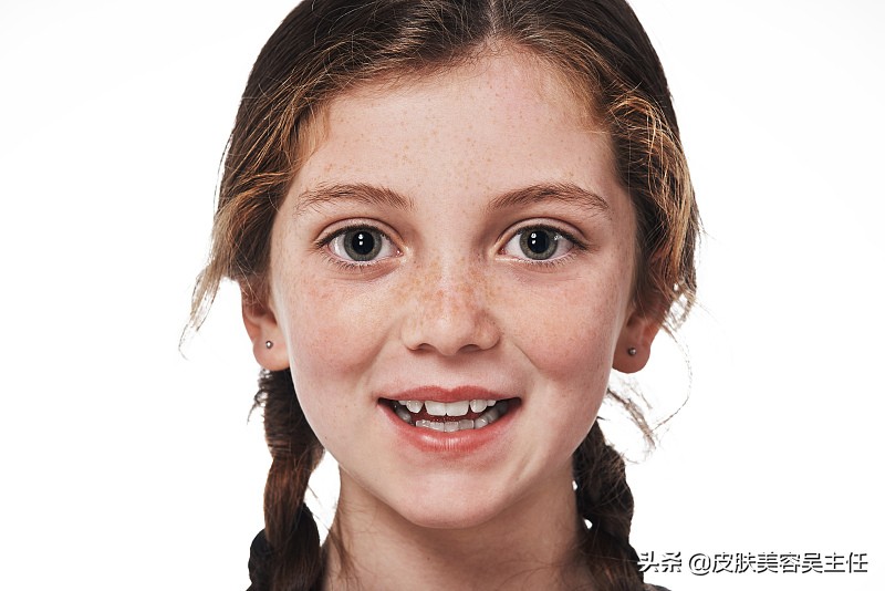 激光祛斑出血和水泡多久可以结痂,激光祛斑结痂不小心擦掉了怎么办