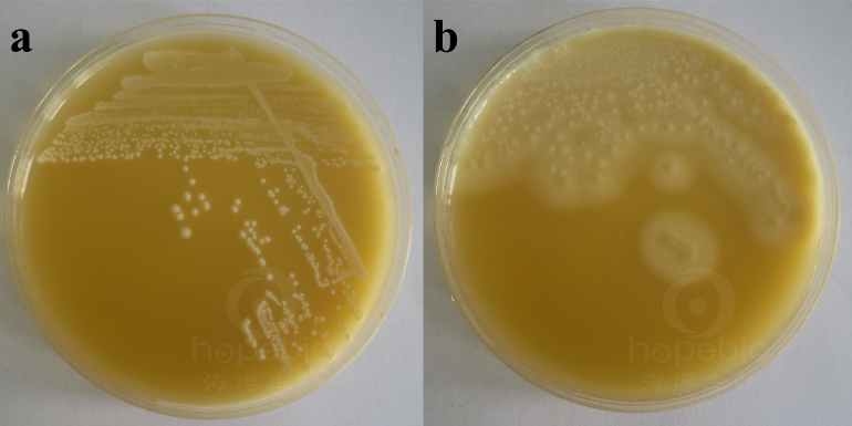 检测产气荚膜梭菌操作示意图,产气荚膜梭菌介绍