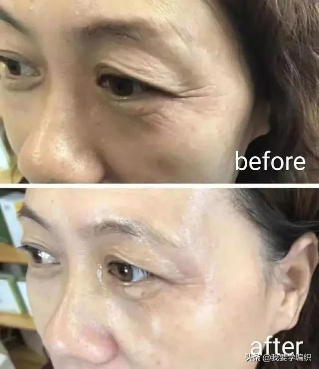 冬天脸干,连皱纹都出来了?日本女博士教你一招,抹几下白白嫩嫩