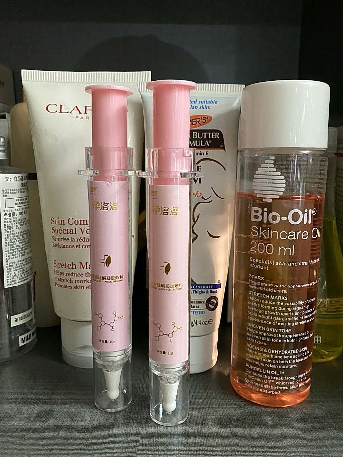 孕期长胎不长肉是不是不长妊娠纹,孕期长胎不长肉运动视频