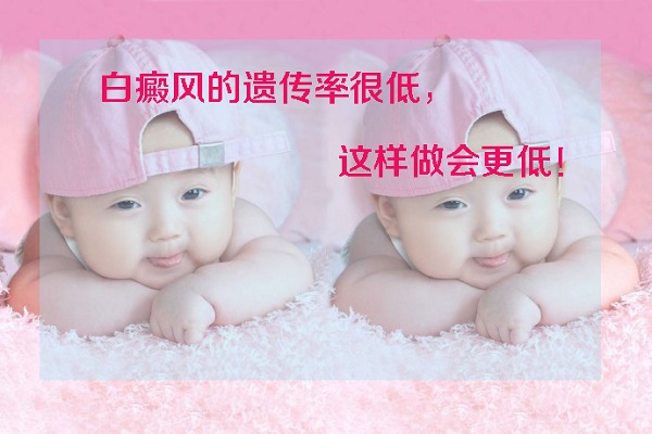 白癜风患者能要孩子吗,白癜风治好后会有遗传吗