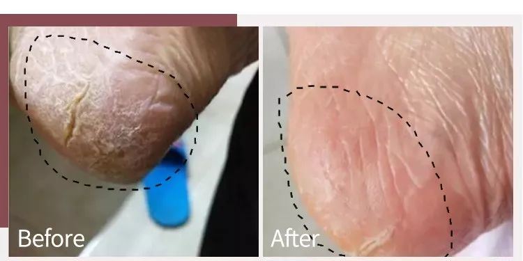 蔡依林皮肤特护霜,蔡依林胶原蛋白粉保养皮肤