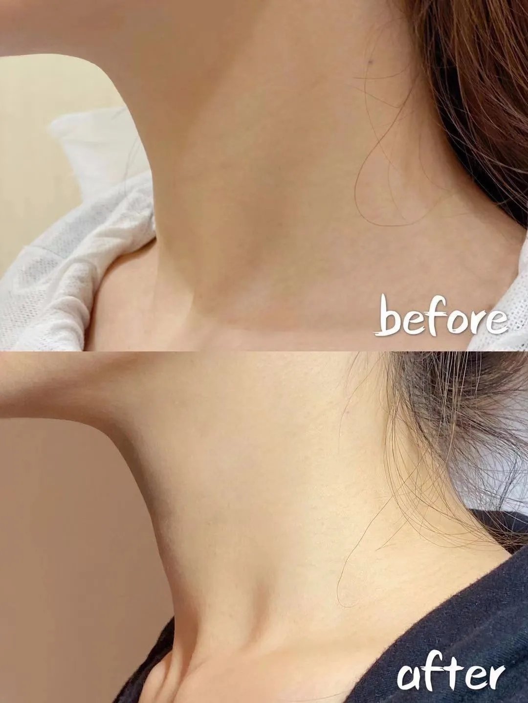 18岁的脸40岁的脖子，你们要的去颈纹指南来啦