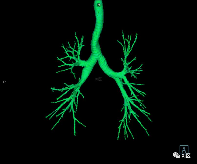 如此详细的肺部影像解剖，有点儿酷！