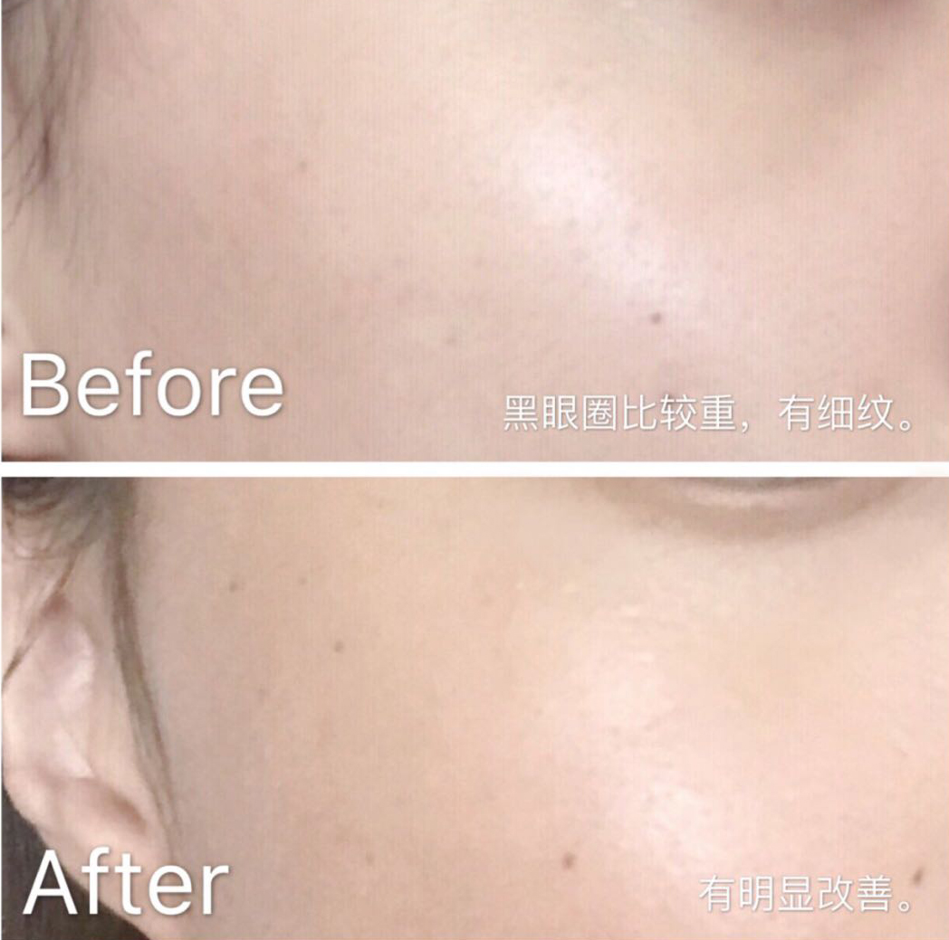 眼霜如何挑选先来看看这篇干货,眼霜排名十大公认好用的眼霜测评