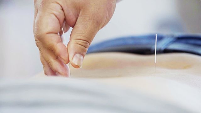 但凭一枚针，悬壶济世人