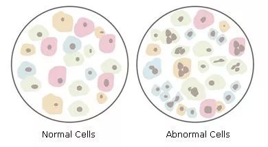 这位医生在妻子身上做了两年研究，挽救了数百万女性的生命