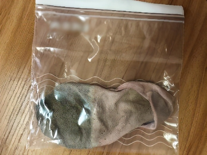 25岁男人脚臭,25岁帅哥脚臭怎么办