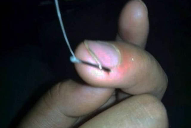 草鱼受伤怎么恢复,10斤草鱼手指受伤