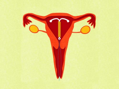 没有套套时，人类为了避孕有多「野」？