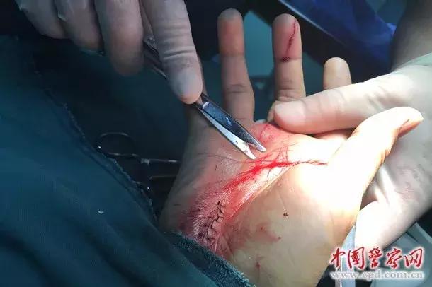 民警抓艾滋毒贩,被艾滋病感染的缉毒警察叫什么