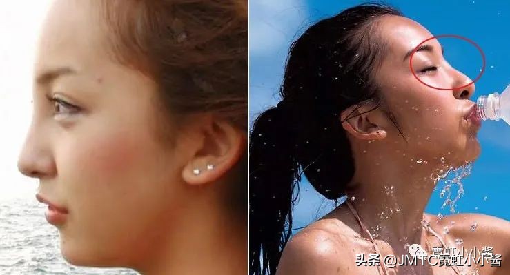 鼻子怎么修复好看呢,鼻型修复方法大全