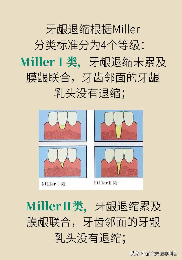 牙根露出来怎样修复不动刀,牙根暴露但没疼痛感怎么办
