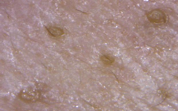 宋威龙对赵露思的评价,宋威龙痘痘肌