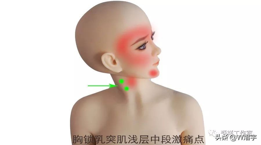 吞咽痛并有痰是什么原因,吞咽时舌下疼怎么办