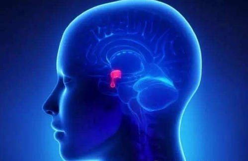 垂体卒中有什么危害,垂体卒中应该怎么治疗