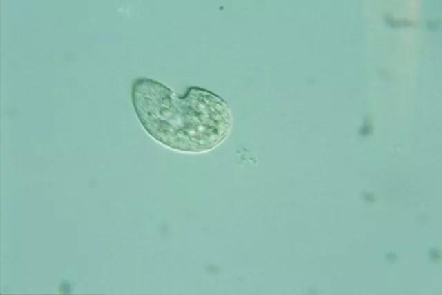 收藏!24种污水处理微生物菌相及指导意义,环保人必看(多图)