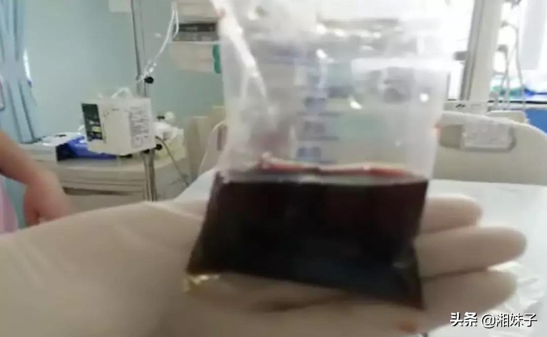 3岁宝宝高烧不退不尿,一周岁孩子高烧完尿是粉红色的