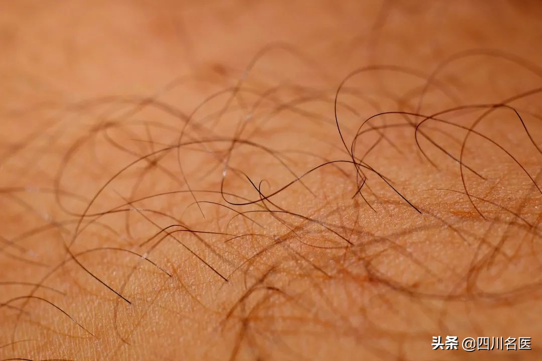 每个人身上都有毛毛表示什么意思,每个人身上都有毛毛怎么办