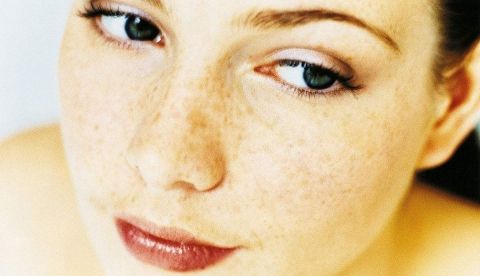 斑中之王黄褐斑一招淡斑,祛斑褐斑