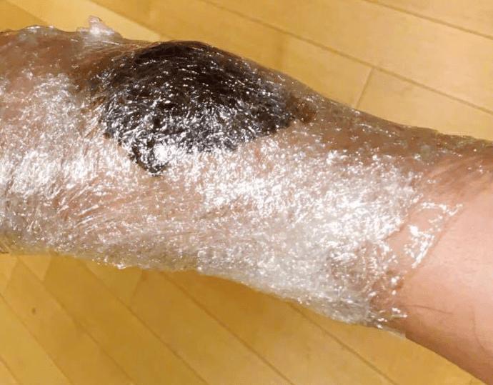 周立波疾病面容,周立波近日晒出照片面容憔悴