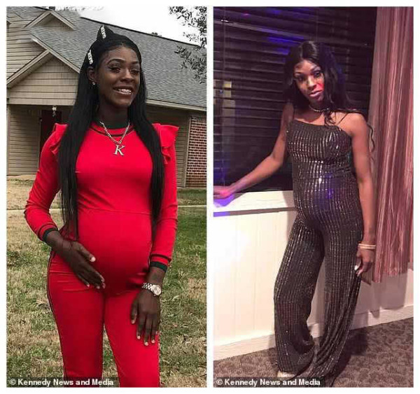 最美胎记小女孩,最美胎记女孩子