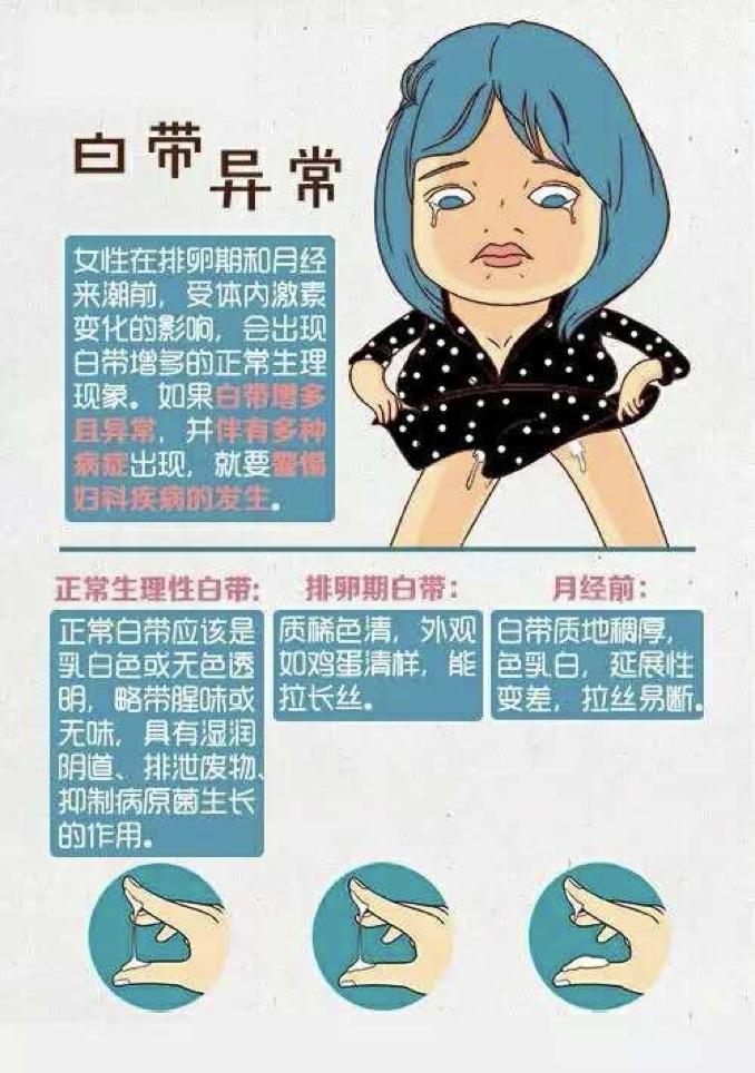 白带异常的辨别,白带异常反反复复