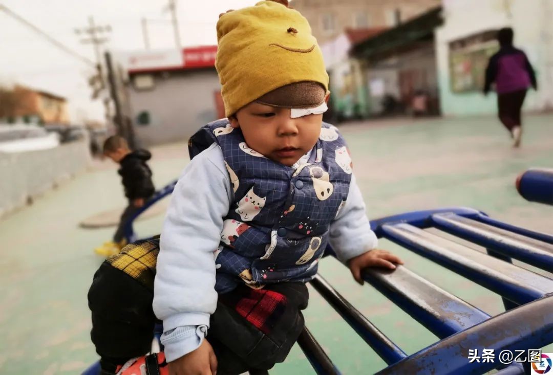 世上最悲催的婴儿,人间悲惨的孩子