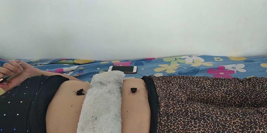 元气虚中医调理,严重元气不足的症状及调理