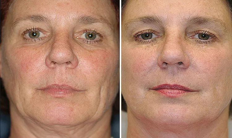 澳洲bio-e花胶液即食深海胶原蛋白,bio-e花胶液怎么辨真假