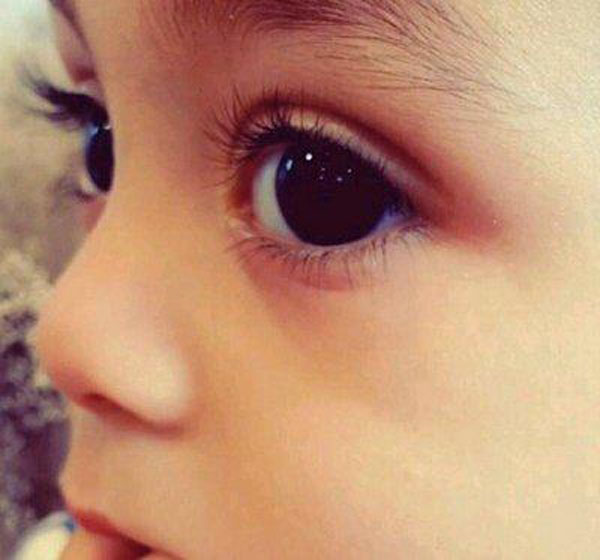 儿童怎么把睫毛养得又长又密,怎么样让孩子睫毛变得又长又浓密