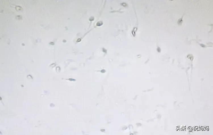 精子不够怎么才能怀孕,精子量少会不会怀不上