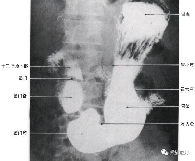 详细的消化道造影+彩色解剖图