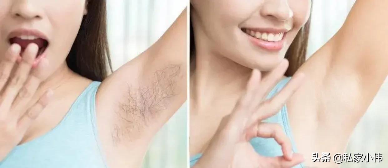 女生突然毛发旺盛是什么原因,为什么有些女生身上毛发很少