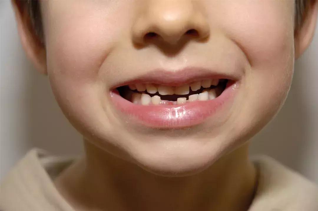 宝宝长牙应该注意什么,宝宝长牙期间有哪些症状怎么缓解