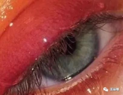 如何让眼睛“变大变美”?这“3种习惯”,给你一双自带特效大眼