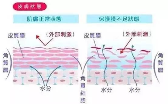 皮肤容易长痘应该修复还是补水,皮肤屏障受损反复长痘怎么控油